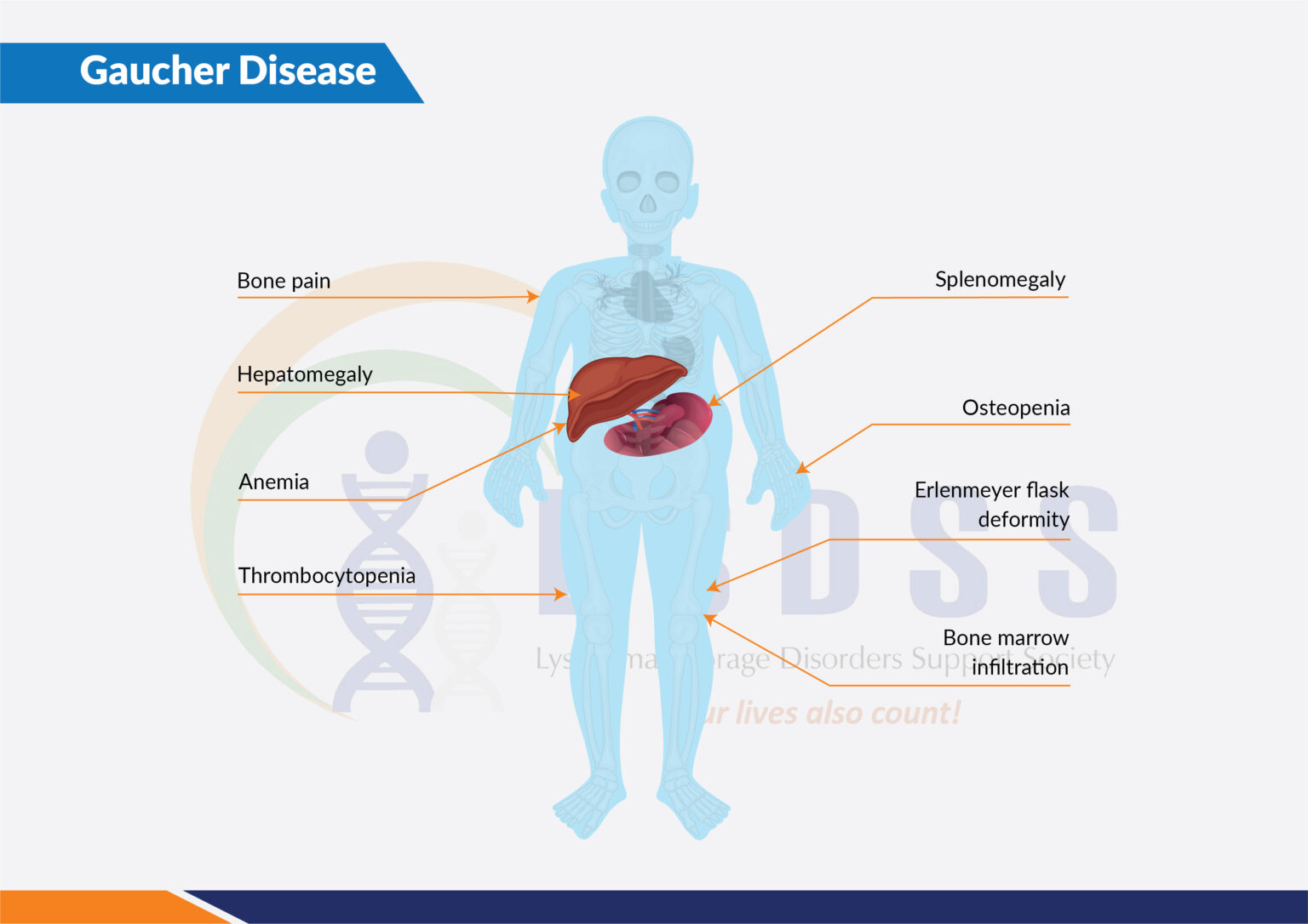 Gaucher Disease LSDSS India