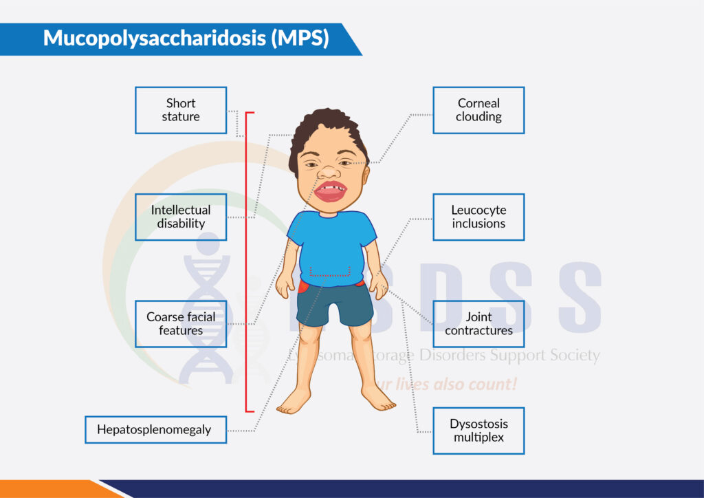 mucopolysaccharidosis-lsdss-india